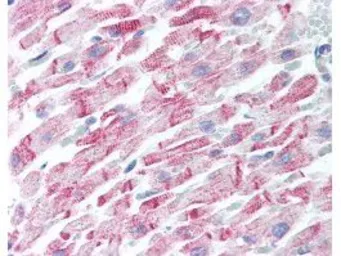 Anti-beta Amyloid antibody used in IHC (Paraffin sections) (IHC-P). GTX82974