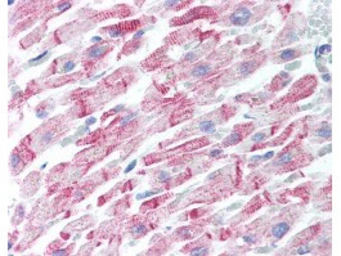 Anti-beta Amyloid antibody used in IHC (Paraffin sections) (IHC-P). GTX82974