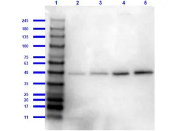 Anti-beta Amyloid antibody used in Western Blot (WB). GTX82974
