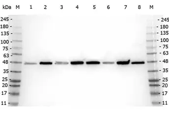 Anti-beta Amyloid antibody used in Western Blot (WB). GTX82974