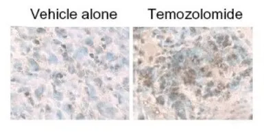 Anti-LC3B antibody used in IHC (Paraffin sections) (IHC-P). GTX82986