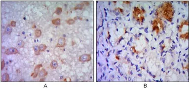 Anti-IRE1 alpha antibody [9F2] used in IHC (Paraffin sections) (IHC-P). GTX82996