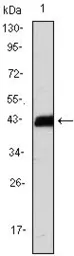 Anti-CD3 zeta antibody [4B10] used in Western Blot (WB). GTX83004