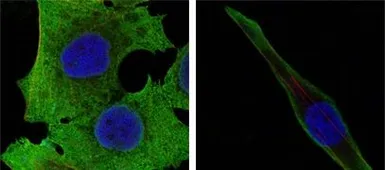 Anti-SOD1 antibody [6F5] used in Immunocytochemistry/ Immunofluorescence (ICC/IF). GTX83012