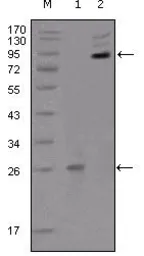 Anti-EphB2 antibody [2D12C6] used in Western Blot (WB). GTX83038