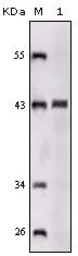 Anti-SorLA antibody [3B6B11] used in Western Blot (WB). GTX83063