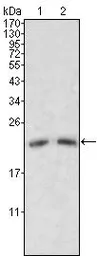 Anti-Apolipoprotein M antibody [8F12C6B8] used in Western Blot (WB). GTX83083