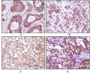 Anti-IKK beta antibody [10A2C5B3] used in IHC (Paraffin sections) (IHC-P). GTX83085
