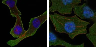 Anti-Calreticulin antibody [1G6A7] used in Immunocytochemistry/ Immunofluorescence (ICC/IF). GTX83089