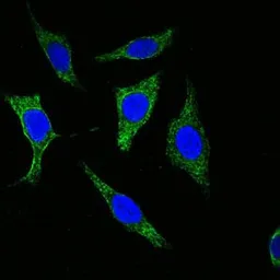 Anti-pan Cytokeratin antibody [7H8] used in Immunocytochemistry/ Immunofluorescence (ICC/IF). GTX83116
