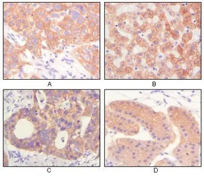 Anti-pan Cytokeratin antibody [7H8] used in IHC (Paraffin sections) (IHC-P). GTX83116