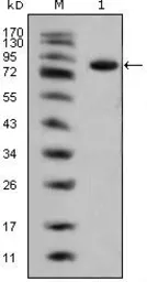Anti-Islet 1 antibody [1B1] used in Western Blot (WB). GTX83120