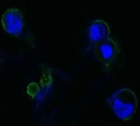 Anti-FGFR4 antibody [7H1] used in Immunocytochemistry/ Immunofluorescence (ICC/IF). GTX83129