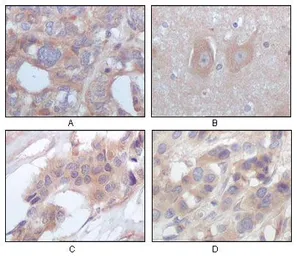 Anti-STYK1 antibody [2H2F10] used in IHC (Paraffin sections) (IHC-P). GTX83202