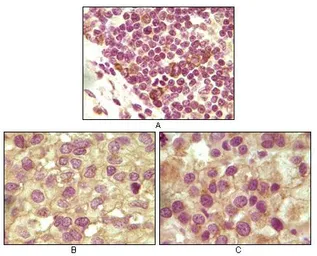 Anti-Inhibin alpha antibody [4A2] used in IHC (Paraffin sections) (IHC-P). GTX83223