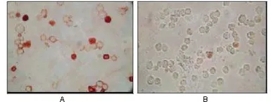 Anti-KSHV ORF62 antibody [5B7B6] used in Immunocytochemistry/ Immunofluorescence (ICC/IF). GTX83235
