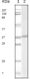 Anti-KSHV ORF62 antibody [5B7B6] used in Western Blot (WB). GTX83235