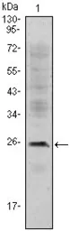 Anti-CD3 epsilon antibody [4E2] used in Western Blot (WB). GTX83278