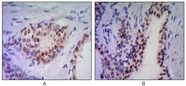 Anti-Nkx3.1 antibody [4H4] used in IHC (Paraffin sections) (IHC-P). GTX83288