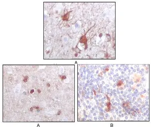 Anti-S100 beta antibody [9A11B9] used in IHC (Paraffin sections) (IHC-P). GTX83327