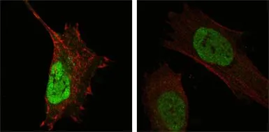 Anti-MDMX / MDM4 antibody [2D10F4] used in Immunocytochemistry/ Immunofluorescence (ICC/IF). GTX83335