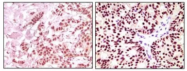 Anti-Estrogen Receptor alpha antibody [2B7] used in IHC (Paraffin sections) (IHC-P). GTX83349