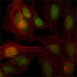 Anti-ThPok antibody [7C12] used in Immunocytochemistry/ Immunofluorescence (ICC/IF). GTX83353