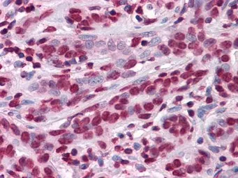Anti-ThPok antibody [7C12] used in IHC (Paraffin sections) (IHC-P). GTX83353