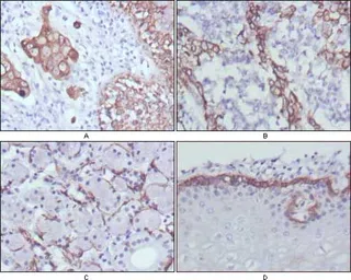 Anti-Cytokeratin 17 antibody [3B12] used in IHC (Paraffin sections) (IHC-P). GTX83366