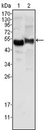 Anti-alpha 1 Antitrypsin antibody [2B12] used in Western Blot (WB). GTX83379