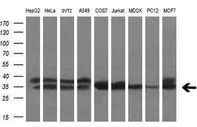 Anti-Tristetraprolin antibody [3D10] used in Western Blot (WB). GTX83405