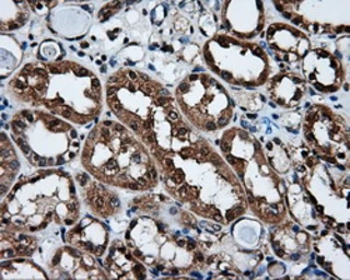 Anti-XRCC1 antibody [2D8] used in IHC (Paraffin sections) (IHC-P). GTX83411