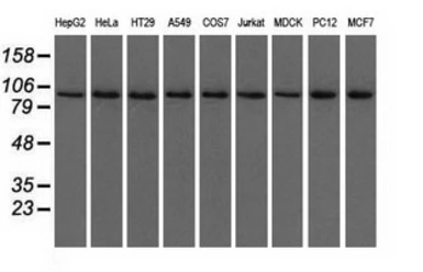 Anti-USP5 antibody [2H5] used in Western Blot (WB). GTX83430