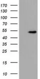 Anti-UHMK1 antibody [2D3] used in Western Blot (WB). GTX83439