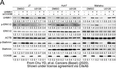 Anti-UHMK1 antibody [5E10] used in Western Blot (WB). GTX83440
