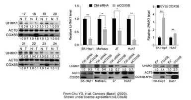 Anti-UHMK1 antibody [5E10] used in Western Blot (WB). GTX83440