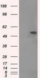 Anti-alpha Tubulin 8 antibody [2G6] used in Western Blot (WB). GTX83462