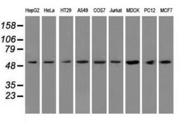 Anti-alpha Tubulin 8 antibody [2G6] used in Western Blot (WB). GTX83462