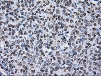 Anti-TTLL12 antibody [4B2] used in IHC (Paraffin sections) (IHC-P). GTX83473