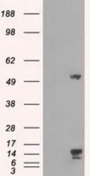 Anti-TMEM100 antibody [1F8] used in Western Blot (WB). GTX83507