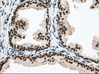 Anti-TACC3 antibody [6F1] used in IHC (Paraffin sections) (IHC-P). GTX83531