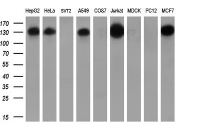 Anti-TACC3 antibody [8F6] used in Western Blot (WB). GTX83534