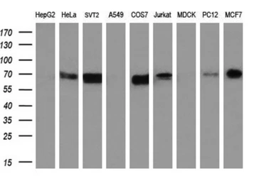 Anti-STK39 antibody [3C12] used in Western Blot (WB). GTX83541