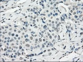 Anti-SSX2 antibody [4A11] used in IHC (Paraffin sections) (IHC-P). GTX83554