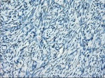 Anti-SSX2 antibody [4D10] used in IHC (Paraffin sections) (IHC-P). GTX83555
