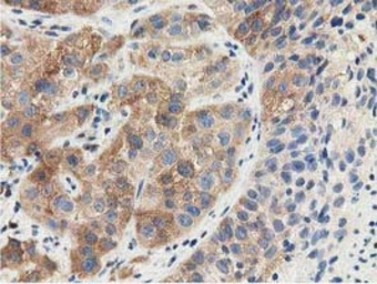 Anti-SSSCA1 antibody [2F5] used in IHC (Paraffin sections) (IHC-P). GTX83556