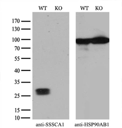 Anti-SSSCA1 antibody [2F5] used in Western Blot (WB). GTX83556