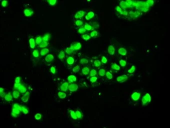 Anti-SSB antibody [1E11] used in Immunocytochemistry/ Immunofluorescence (ICC/IF). GTX83558