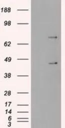 Anti-SSB antibody [3H9] used in Western Blot (WB). GTX83560