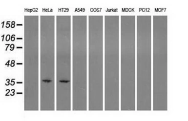 Anti-Sorbitol Dehydrogenase antibody [2A10] used in Western Blot (WB). GTX83583